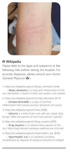 Baixar Model Dermatol – Atlas de Doenças de Pele Grátis - Screenshot 7